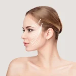 Why Choose a Deep Plane Facelift