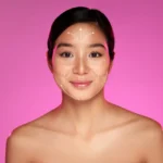 Facelift Treatment Journey