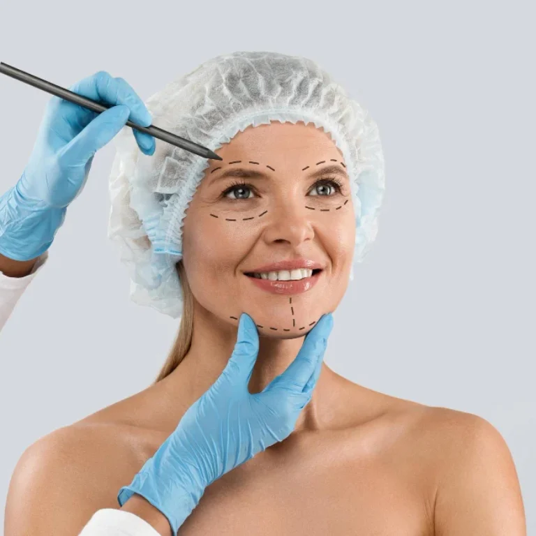Best Facelift Surgeon London.jpg