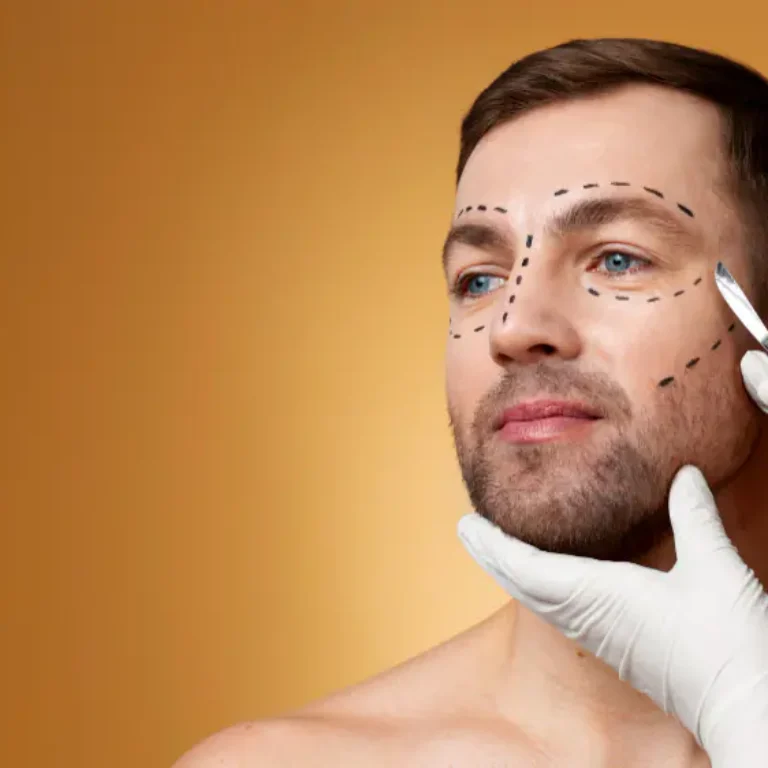 Deep Plane Facelift for Men.jpg