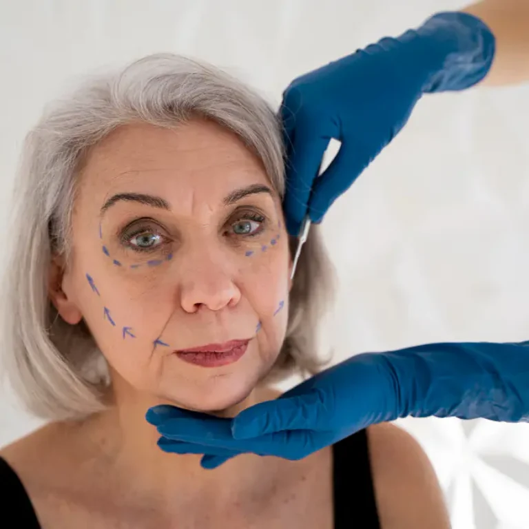 Is 70 Too Old for a Facelift.jpg (1)