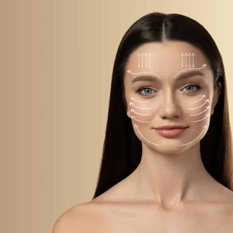 The Deep Plane Facelift