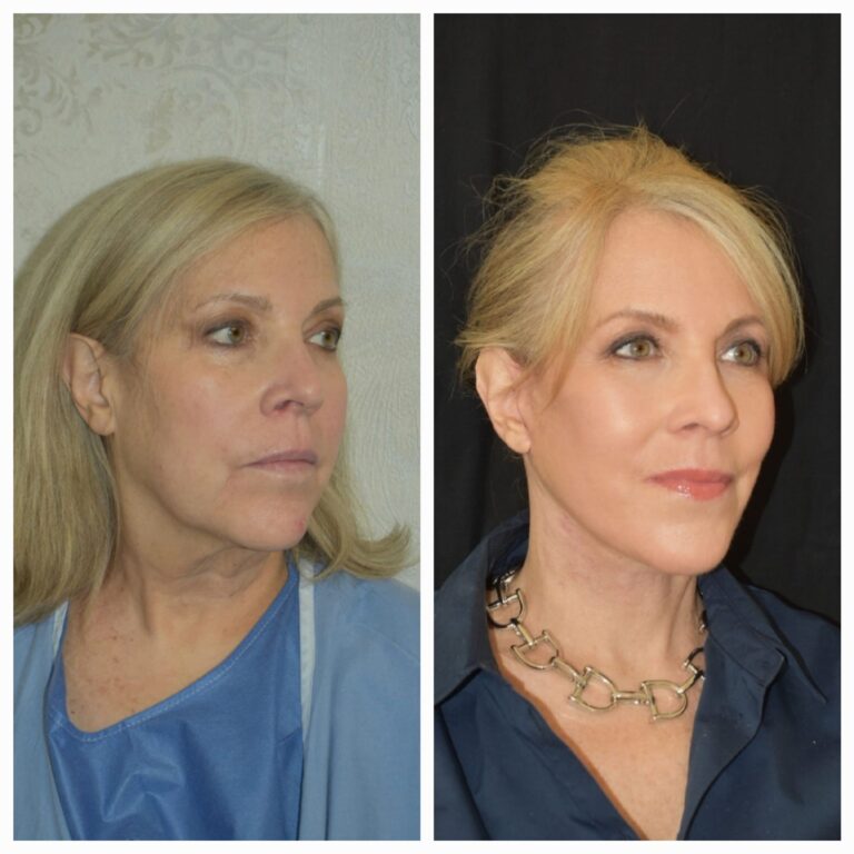 WhatsApp Image 2025-07-02 at 1.24.23 PM