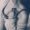 breast-augmentation---what-to-expect-post-op