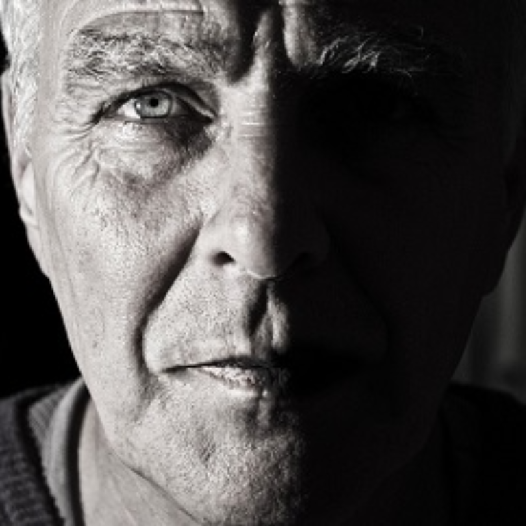 facelift-surgery-on-the-rise-amo