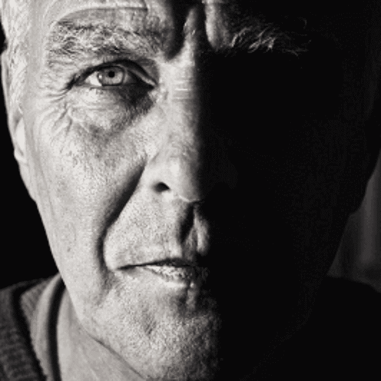 facelift-surgery-on-the-rise-amo