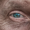 skin-400